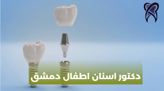 دكتور اسنان اطفال دمشق