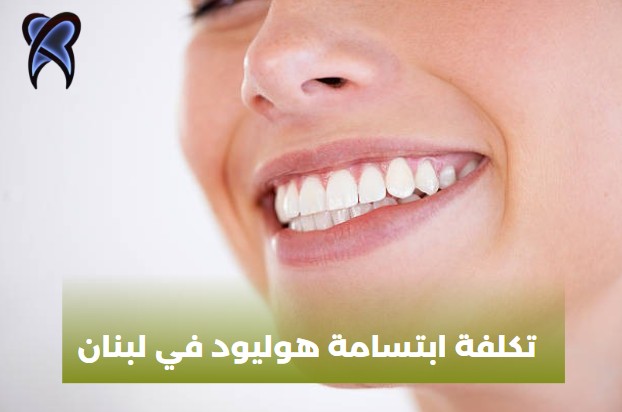 تكلفة ابتسامة هوليود في ألمانيا