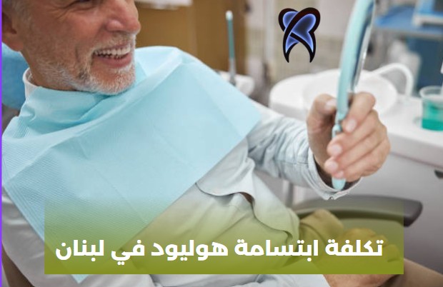 تكلفة ابتسامة هوليود في لبنان