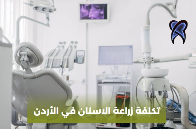 زراعة الاسنان بالليزر في الأردن
