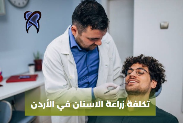 تكلفة زراعة الاسنان في الأردن