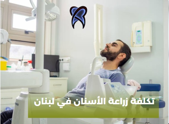 تكلفة زراعة الاسنان في تركيا