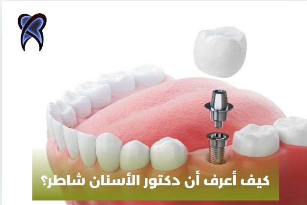 كيف أعرف أن دكتور الأسنان شاطر؟