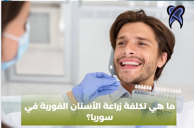 ما هي تكلفة زراعة الأسنان الفورية في سوريا؟