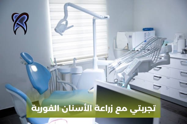 زراعة فورية للاسنان زراعة فورية للاسنان