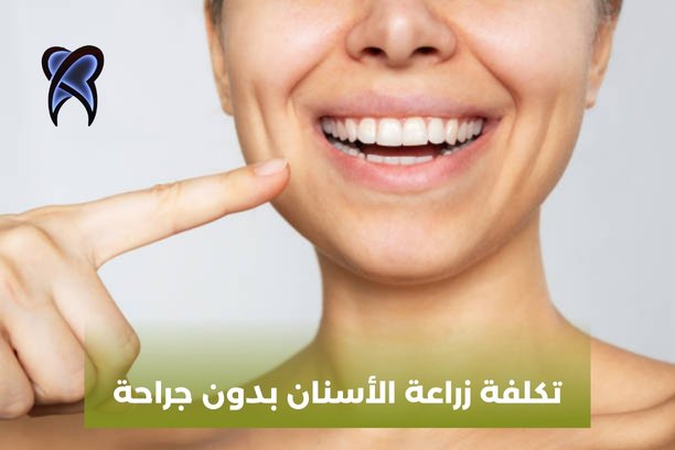 تكلفة زراعة الأسنان بدون جراحة