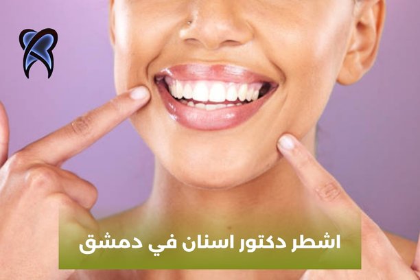 اشطر دكتور اسنان في دمشق