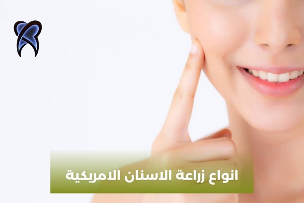 انواع زراعة الاسنان الامريكية