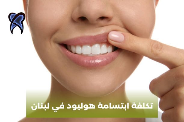 تكلفة ابتسامة هوليود في لبنان