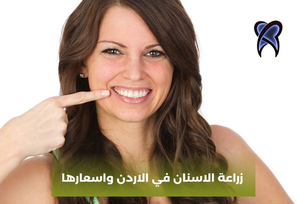 زراعة الاسنان في الاردن واسعارها