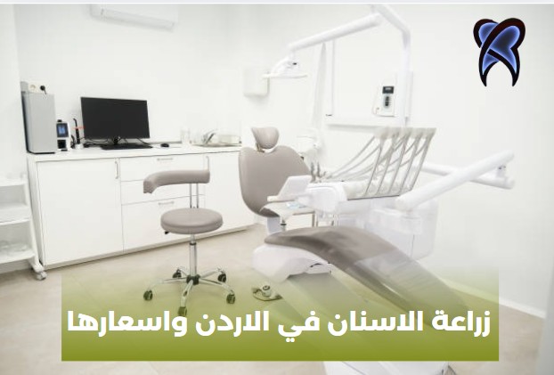 كم زراعة الاسنان في الاردن
