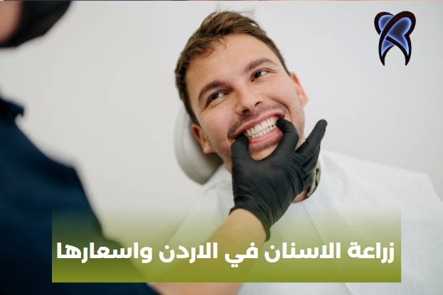 زراعة الاسنان في الاردن واسعارها