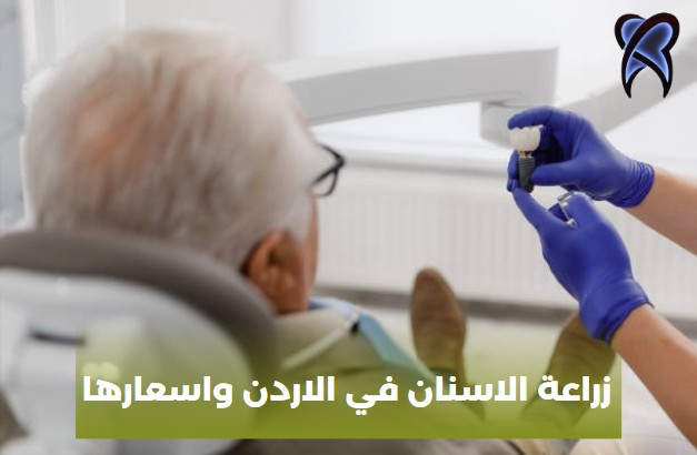 زراعة الاسنان في الاردن واسعارها