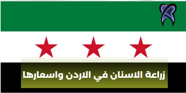 زراعة الاسنان في الاردن واسعارها