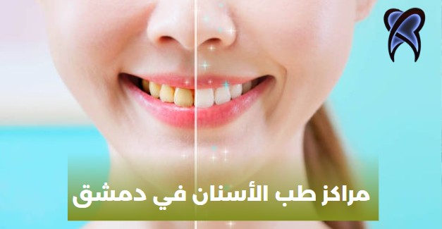 دكتور الاسنان في دمشق