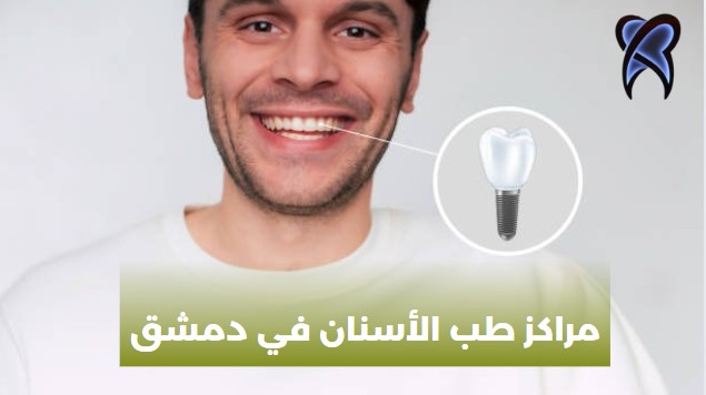 مراكز طب الأسنان في دمشق