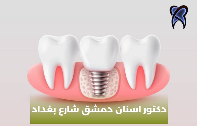 دكتور اسنان أطفال دمشق