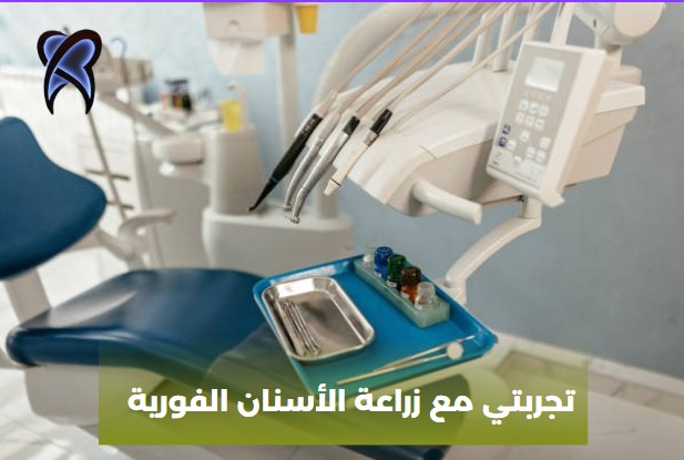 زراعة الاسنان فورية