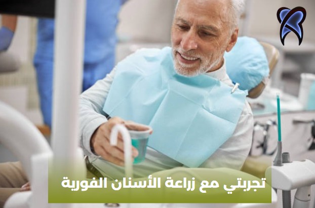 تجربتي مع زراعة الأسنان الفورية