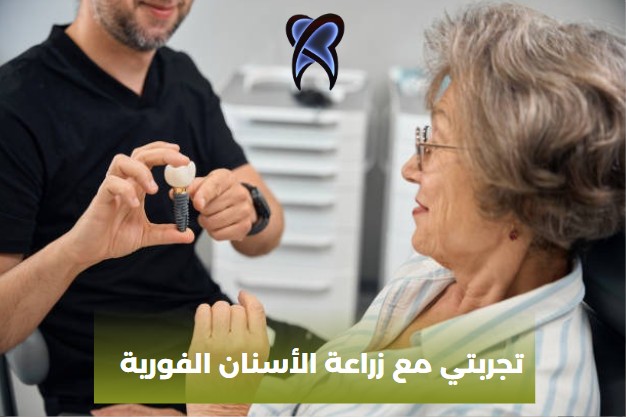 تجربتي مع زراعة الأسنان الفورية