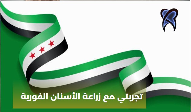 تجربتي مع زراعة الأسنان الفورية