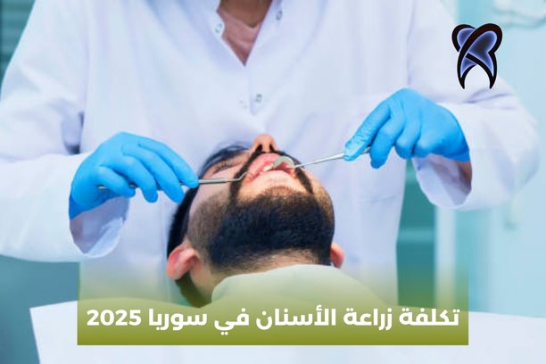 تكلفة زراعة الاسنان في تركيا 2025 تكلفة زراعة الاسنان في تركيا 2025