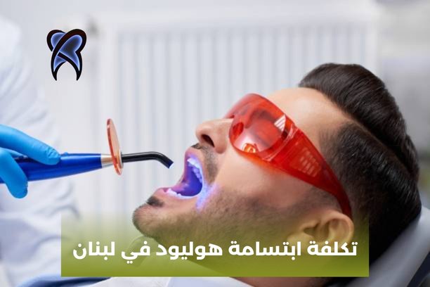 ابتسامة هوليود في تركيا اسعار