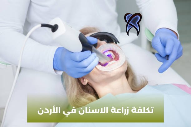 كم زراعة الاسنان في الأردن