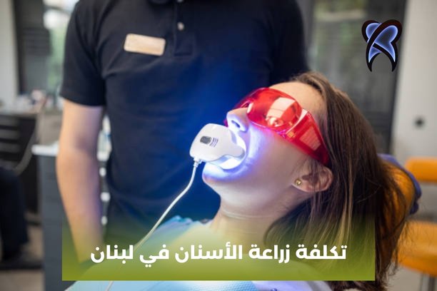 تكلفة زراعة الاسنان في بيروت