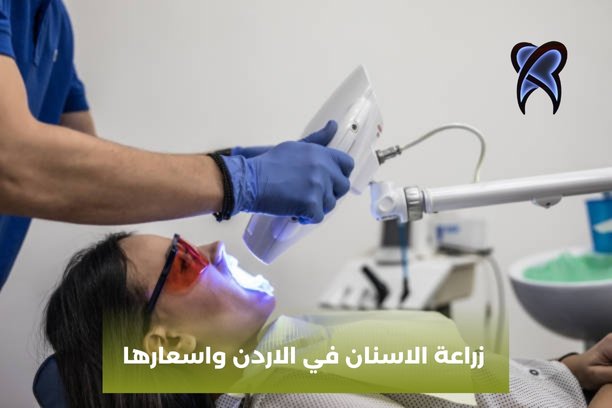 زراعة الاسنان الفورية في الاردن