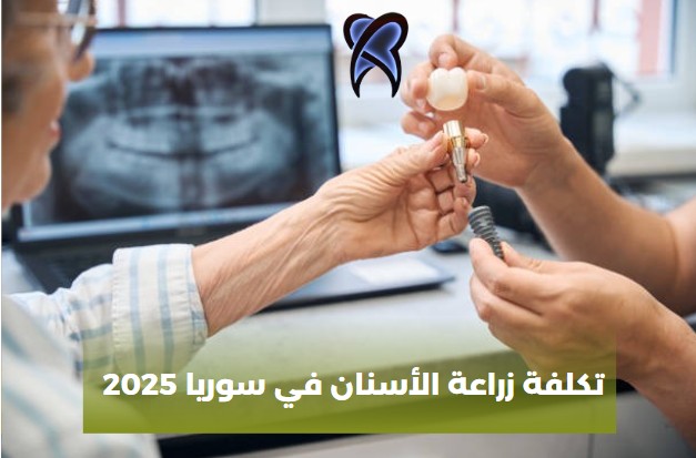 تكلفة زراعة الأسنان في سوريا 2025
