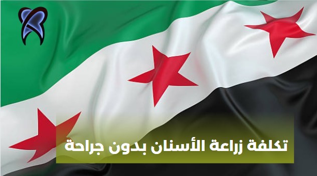 تكلفة زراعة الأسنان بدون جراحة