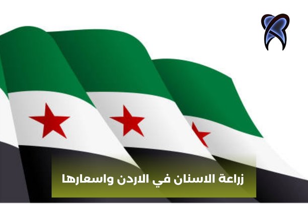 زراعة الاسنان في الاردن واسعارها