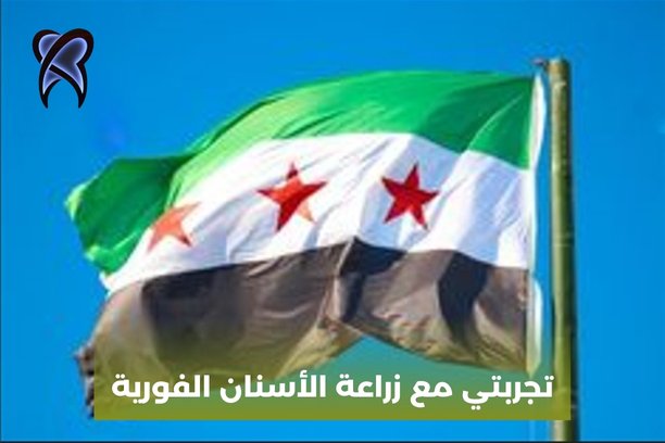 تجربتي مع زراعة الأسنان الفورية تجربتي مع زراعة الأسنان الفورية