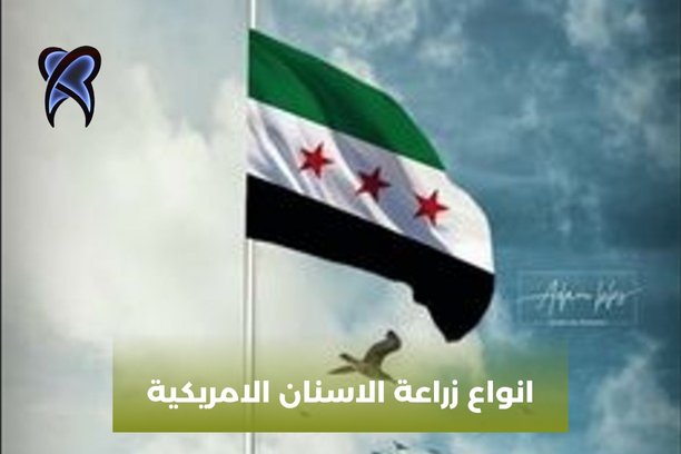 انواع زراعة الاسنان الامريكية