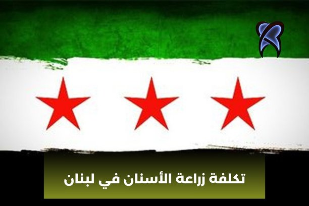 تكلفة زراعة الأسنان في لبنان