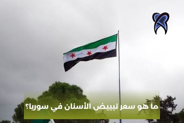 ما هو سعر تبييض الأسنان في سوريا؟