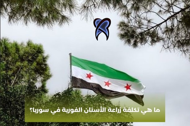 ما هي تكلفة زراعة الأسنان الفورية في سوريا؟
