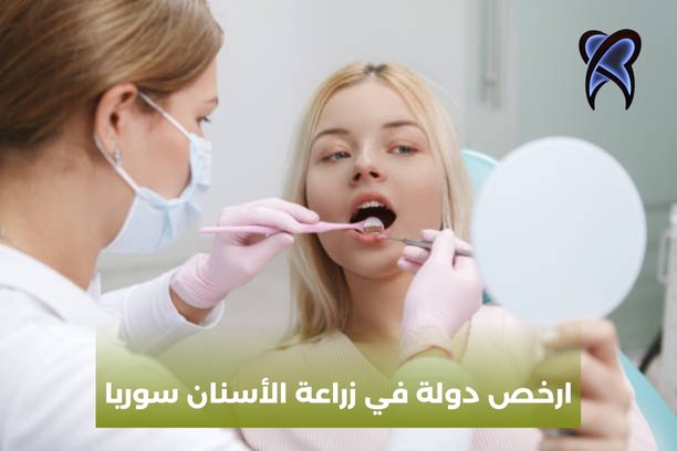 زراعة اسنان في سوريا زراعة اسنان في سوريا
