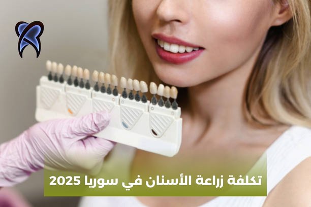 تكلفة زراعة الأسنان في سوريا 2025 تكلفة زراعة الأسنان في سوريا 2025
