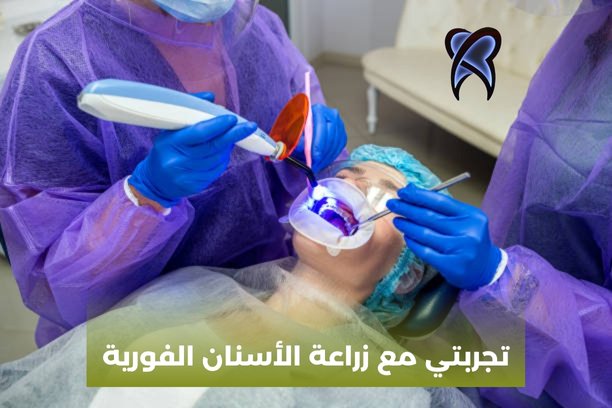 زراعة اسنان فورية زراعة اسنان فورية
