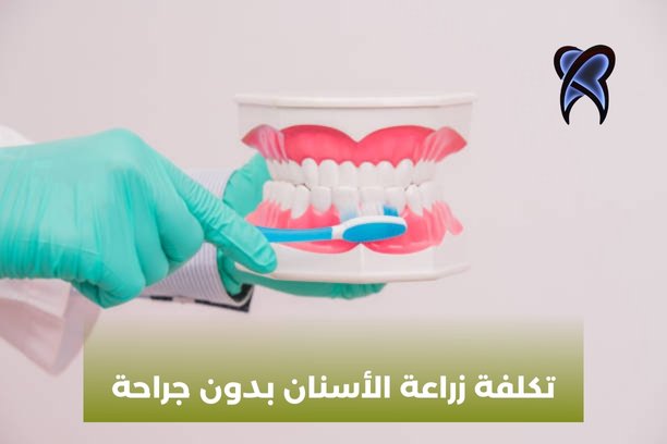 أنواع زراعة الأسنان الألمانية