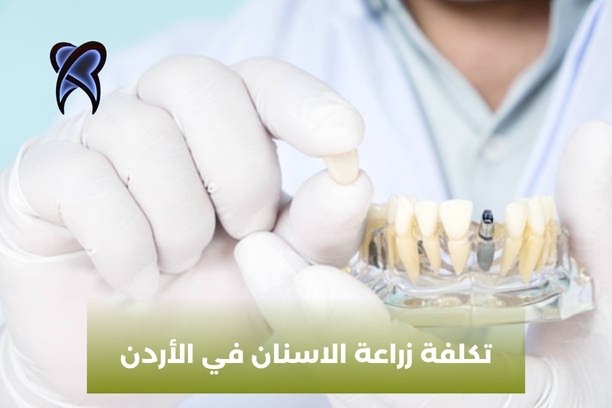 مراكز زراعة الاسنان في الأردن