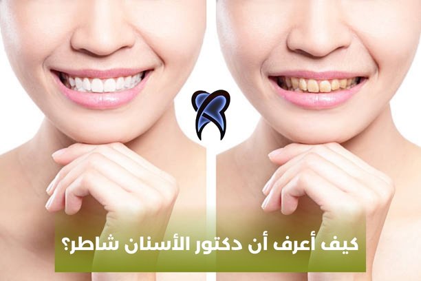 كيف أعرف أن دكتور الأسنان شاطر؟