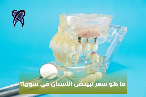 ما هي أسعار أسنان الزيركون في سوريا؟