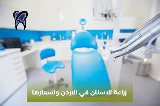 زراعة الاسنان في الاردن