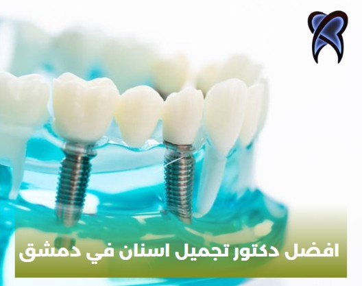 افضل دكتور تجميل اسنان في دمشق