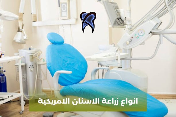 انواع زرعات الاسنان وافضلها