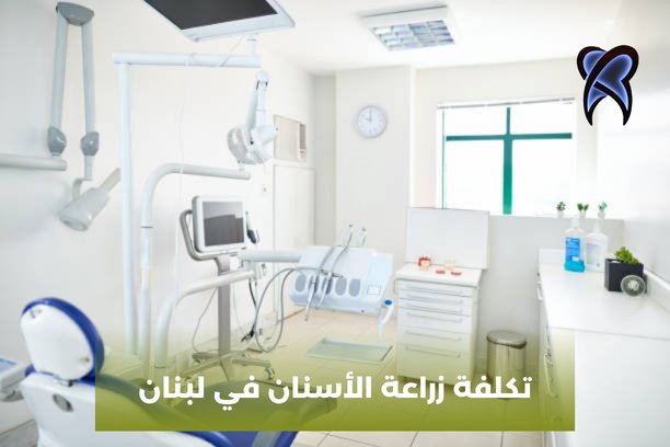 كم تكلفة زراعة الاسنان في لبنان