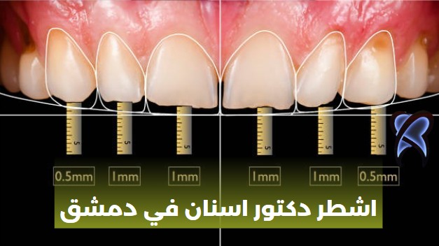 اشطر دكتور اسنان في دمشق
